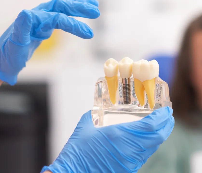 Implante Dentário